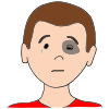 Black Eye