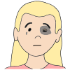 Black Eye