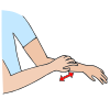 Itch  Picture