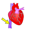 Inferior Vena Cava Picture