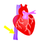 Inferior Vena Cava Stencil