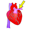 Pulmonary Artery Picture