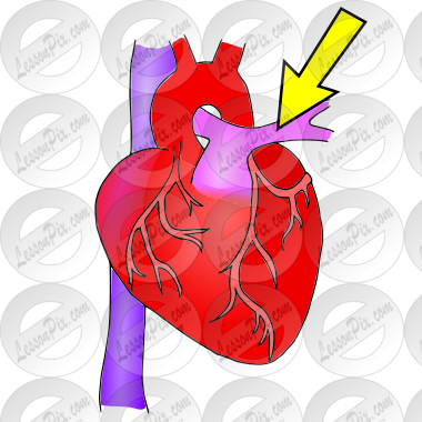 Pulmonary Artery Picture