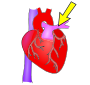 Pulmonary Artery