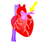 Pulmonary Artery Stencil