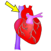 Superior Vena Cava Picture