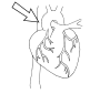 Superior Vena Cava Outline