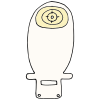 Ileostomy  Picture