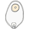 Urostomy  Picture