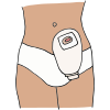 Colostomy Pouch  Picture