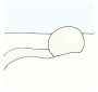 Snowball
