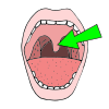 Uvula Picture